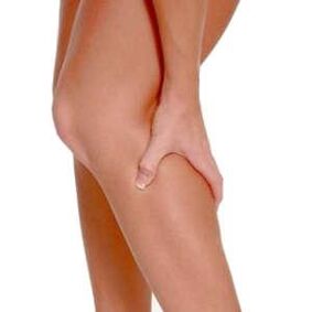 Varicose veins on their feet